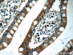Carboxypeptidase A3 Rabbit anti-Human, Mouse, Rat, Polyclonal, Proteintech:Antibodies:Primary