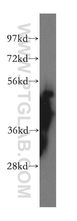 WRNIP1 Rabbit anti-Human, Mouse, Rat, Polyclonal, Proteintech