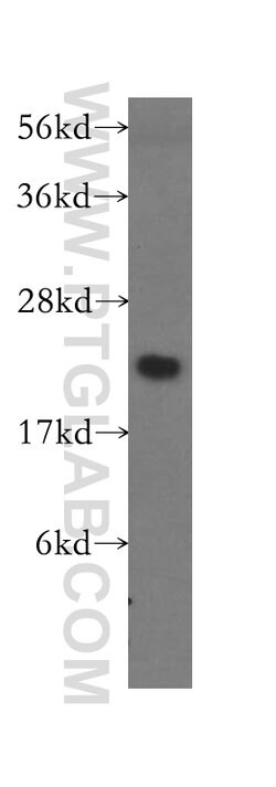 MRPL13 Rabbit anti-Human, Mouse, Non-human primate, Rat, Polyclonal, Proteintech 150 &mu;L | Buy Online | Proteintech | Fisher Scientific