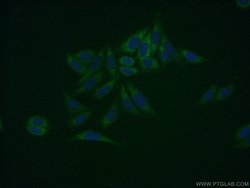 SDSL Rabbit anti-Human, Mouse, Polyclonal, Proteintech 20 &mu;L; Unconjugated:Antibodies,
