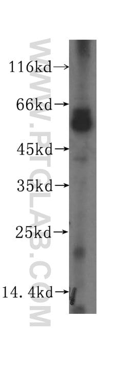 SDSL Rabbit anti-Human, Mouse, Polyclonal, Proteintech 20 &mu;L; Unconjugated:Antibodies,