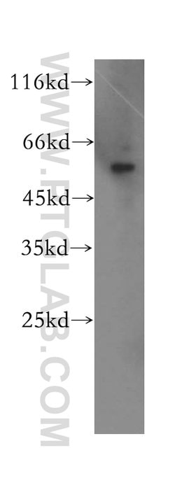 SDSL Rabbit anti-Human, Mouse, Polyclonal, Proteintech 20 &mu;L; Unconjugated:Antibodies,