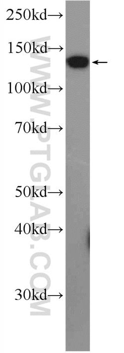 KRI1 Rabbit anti-Human, Mouse, Rat, Polyclonal, Proteintech:Antibodies:Primary