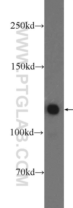 KRI1 Rabbit anti-Human, Mouse, Rat, Polyclonal, Proteintech:Antibodies:Primary