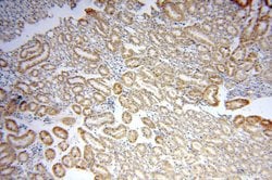 LMF2 Rabbit anti-Human, Mouse, Rat, Polyclonal, Proteintech 150 &mu;L;