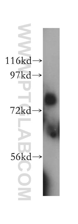 LMF2 Rabbit anti-Human, Mouse, Rat, Polyclonal, Proteintech 150 &mu;L;