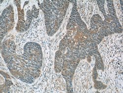 DMKN Rabbit anti-Human, Mouse, Rat, Polyclonal, Proteintech 150 &mu;L;