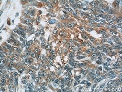 DMKN Rabbit anti-Human, Mouse, Rat, Polyclonal, Proteintech 150 &mu;L;