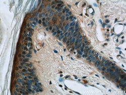 DMKN Rabbit anti-Human, Mouse, Rat, Polyclonal, Proteintech 150 &mu;L;