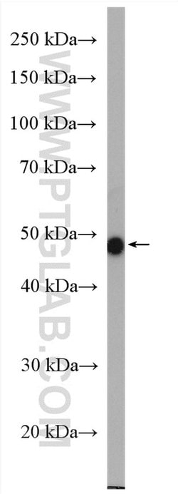 DMKN Rabbit anti-Human, Mouse, Rat, Polyclonal, Proteintech 150 &mu;L;