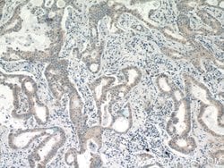 MRPL1 Rabbit anti-Human, Mouse, Rat, Polyclonal, Proteintech:Antibodies:Primary