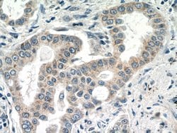 MRPL1 Rabbit anti-Human, Mouse, Rat, Polyclonal, Proteintech:Antibodies:Primary