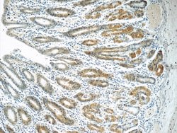 MRPL1 Rabbit anti-Human, Mouse, Rat, Polyclonal, Proteintech:Antibodies:Primary