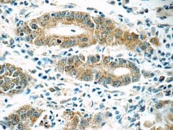 MRPL1 Rabbit anti-Human, Mouse, Rat, Polyclonal, Proteintech:Antibodies:Primary