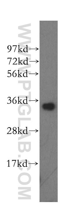 MRPL1 Rabbit anti-Human, Mouse, Rat, Polyclonal, Proteintech:Antibodies:Primary