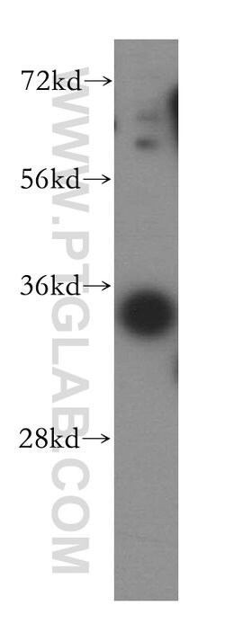 MRPL1 Rabbit anti-Human, Mouse, Rat, Polyclonal, Proteintech:Antibodies:Primary