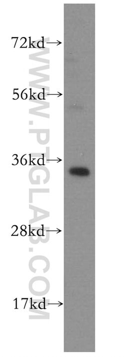 MRPL1 Rabbit anti-Human, Mouse, Rat, Polyclonal, Proteintech:Antibodies:Primary
