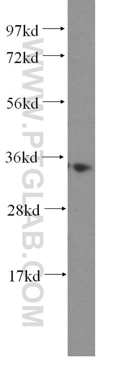 MRPL1 Rabbit anti-Human, Mouse, Rat, Polyclonal, Proteintech:Antibodies:Primary
