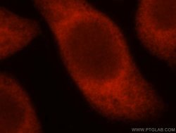 TSR2 Rabbit anti-Human, Mouse, Rat, Polyclonal, Proteintech 20 &mu;L; Unconjugated:Antikörper