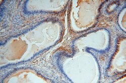 TSR2 Rabbit anti-Human, Mouse, Rat, Polyclonal, Proteintech 20 &mu;L; Unconjugated:Antikörper
