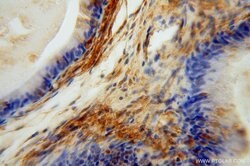 TSR2 Rabbit anti-Human, Mouse, Rat, Polyclonal, Proteintech 20 &mu;L; Unconjugated:Antikörper