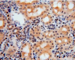 TSR2 Rabbit anti-Human, Mouse, Rat, Polyclonal, Proteintech 20 &mu;L; Unconjugated:Antikörper