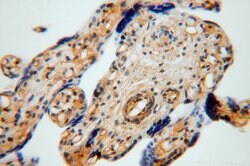 TSR2 Rabbit anti-Human, Mouse, Rat, Polyclonal, Proteintech 20 &mu;L; Unconjugated:Antikörper