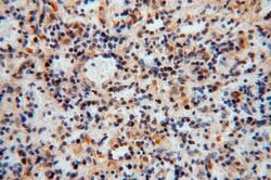 TSR2 Rabbit anti-Human, Mouse, Rat, Polyclonal, Proteintech 20 &mu;L; Unconjugated:Antikörper