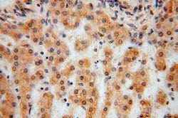 TSR2 Rabbit anti-Human, Mouse, Rat, Polyclonal, Proteintech 20 &mu;L; Unconjugated:Antikörper