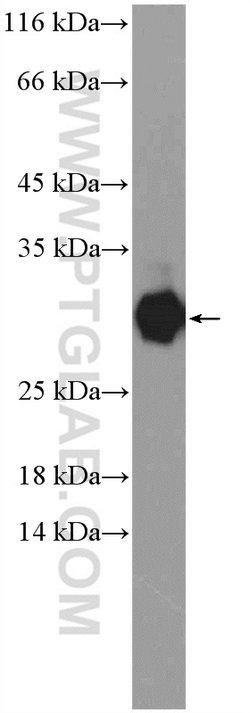 TSR2 Rabbit anti-Human, Mouse, Rat, Polyclonal, Proteintech 20 &mu;L; Unconjugated:Antikörper