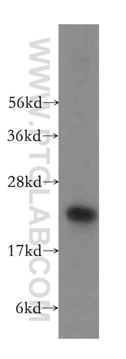 TSR2 Rabbit anti-Human, Mouse, Rat, Polyclonal, Proteintech 20 &mu;L; Unconjugated:Antikörper