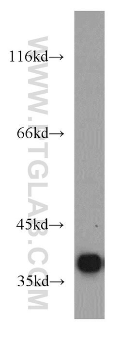 PQBP1 Rabbit anti-Human, Mouse, Rat, Polyclonal, Proteintech