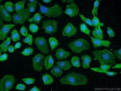 GCC1 Rabbit anti-Human, Mouse, Rat, Polyclonal, Proteintech:Antibodies:Primary
