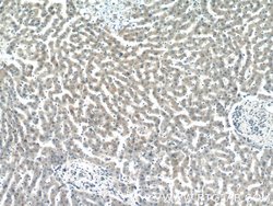 GCC1 Rabbit anti-Human, Mouse, Rat, Polyclonal, Proteintech:Antibodies:Primary