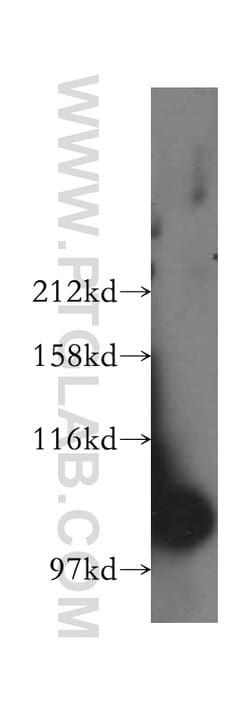 GCC1 Rabbit anti-Human, Mouse, Rat, Polyclonal, Proteintech:Antibodies:Primary