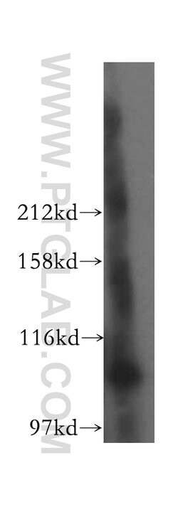 GCC1 Rabbit anti-Human, Mouse, Rat, Polyclonal, Proteintech:Antibodies:Primary