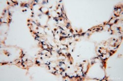 ATP6V1C2 Rabbit anti-Human, Mouse, Polyclonal, Proteintech 150 &mu;L; Unconjugated:Antibodies,