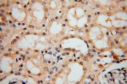 ATP6V1C2 Rabbit anti-Human, Mouse, Polyclonal, Proteintech 150 &mu;L; Unconjugated:Antibodies,