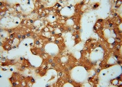 ATP6V1C2 Rabbit anti-Human, Mouse, Polyclonal, Proteintech 150 &mu;L; Unconjugated:Antibodies,