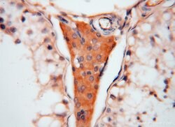 ATP6V1C2 Rabbit anti-Human, Mouse, Polyclonal, Proteintech 150 &mu;L; Unconjugated:Antibodies,