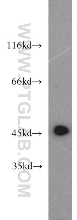 ATP6V1C2 Rabbit anti-Human, Mouse, Polyclonal, Proteintech 150 &mu;L; Unconjugated:Antibodies,