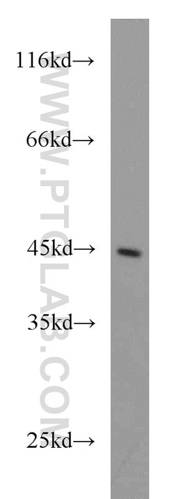 ATP6V1C2 Rabbit anti-Human, Mouse, Polyclonal, Proteintech 150 &mu;L; Unconjugated:Antibodies,