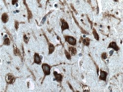 G3BP2 Rabbit anti-Human, Polyclonal, Proteintech:Antibodies:Primary Antibodies