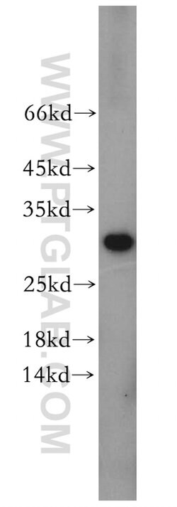 CHMP6 Rabbit anti-Human, Mouse, Rat, Polyclonal, Proteintech 20 &mu;L;