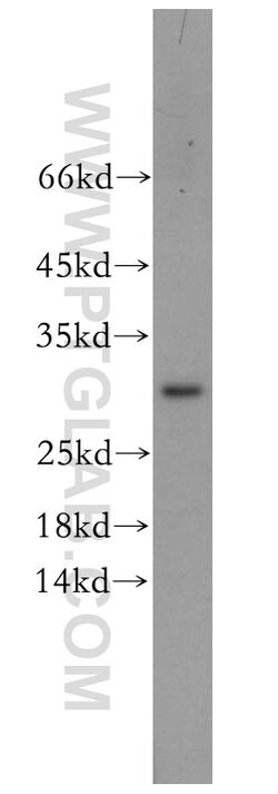 CHMP6 Rabbit anti-Human, Mouse, Rat, Polyclonal, Proteintech 20 &mu;L;