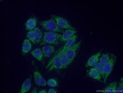 MRPS36 Rabbit anti-Human, Mouse, Rat, Polyclonal, Proteintech 150 &mu;L;