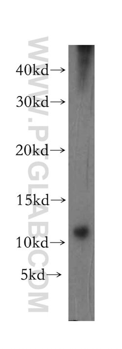 MRPS36 Rabbit anti-Human, Mouse, Rat, Polyclonal, Proteintech 150 &mu;L;