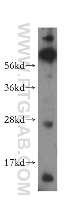 MRPS36 Rabbit anti-Human, Mouse, Rat, Polyclonal, Proteintech 150 &mu;L;