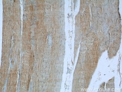 MYL12A Rabbit anti-Human, Mouse, Rat, Polyclonal, Proteintech 150 &mu;L;