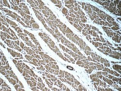MYL12A Rabbit anti-Human, Mouse, Rat, Polyclonal, Proteintech 150 &mu;L;